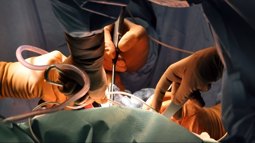 The Ultimate Advanced Hystero Laparoscopy main image