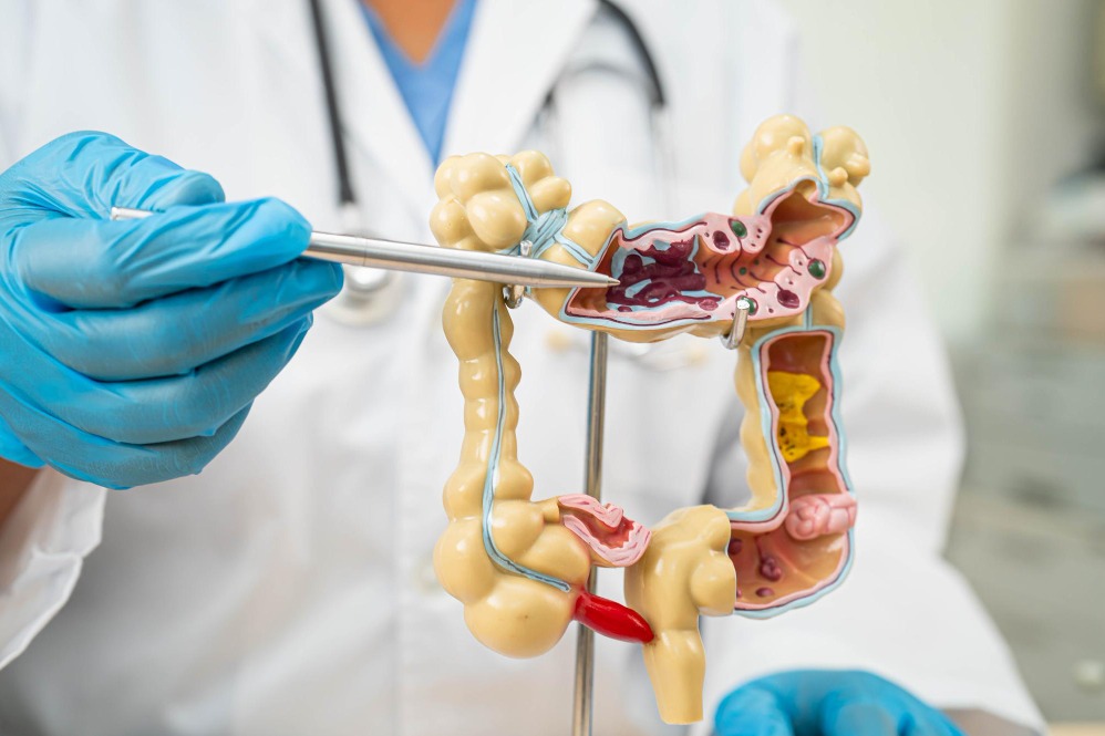 Appendix Surgeon in Dombivli – Timely Surgical Care for Appendicitis by Dr.Tejas Savdekar main image