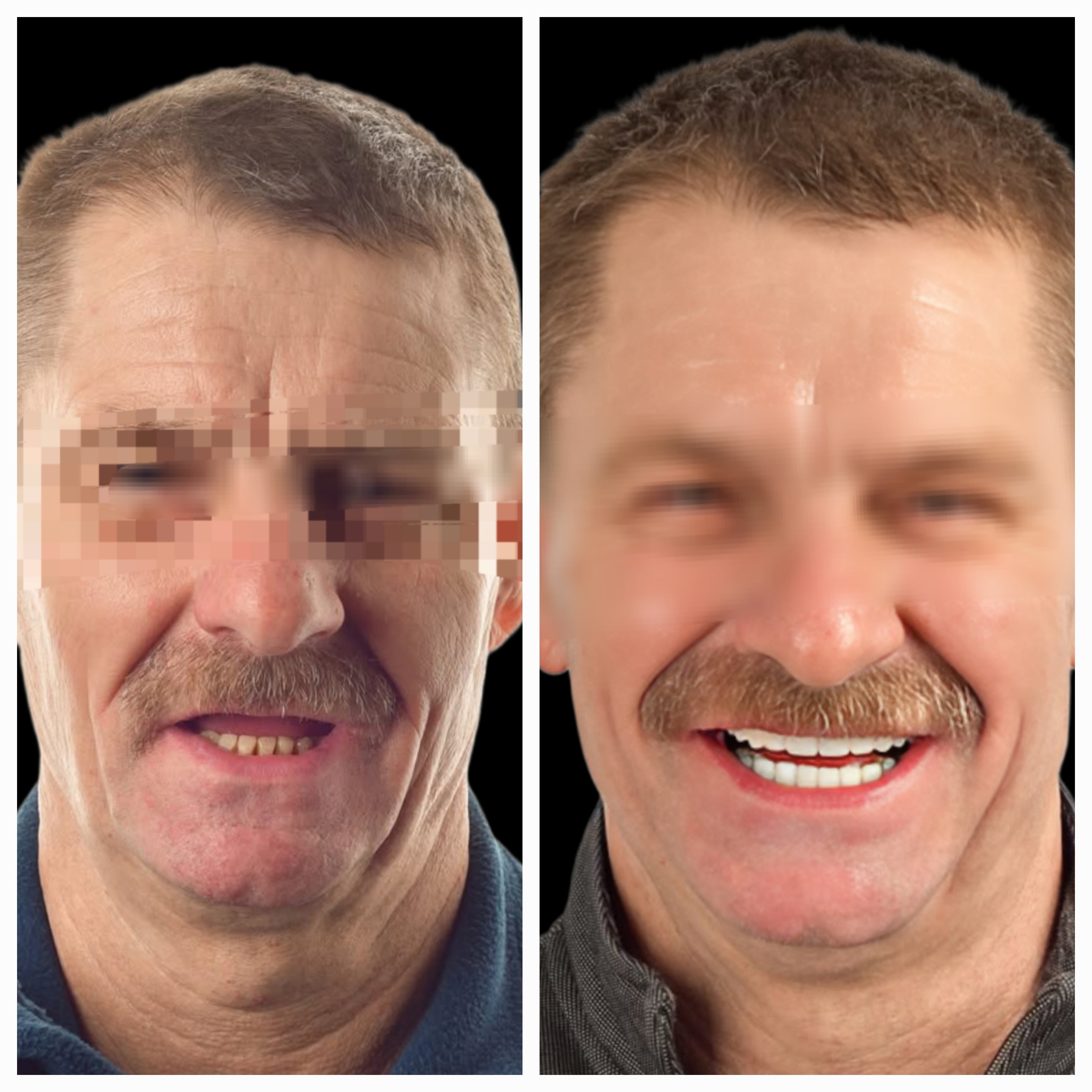 update image