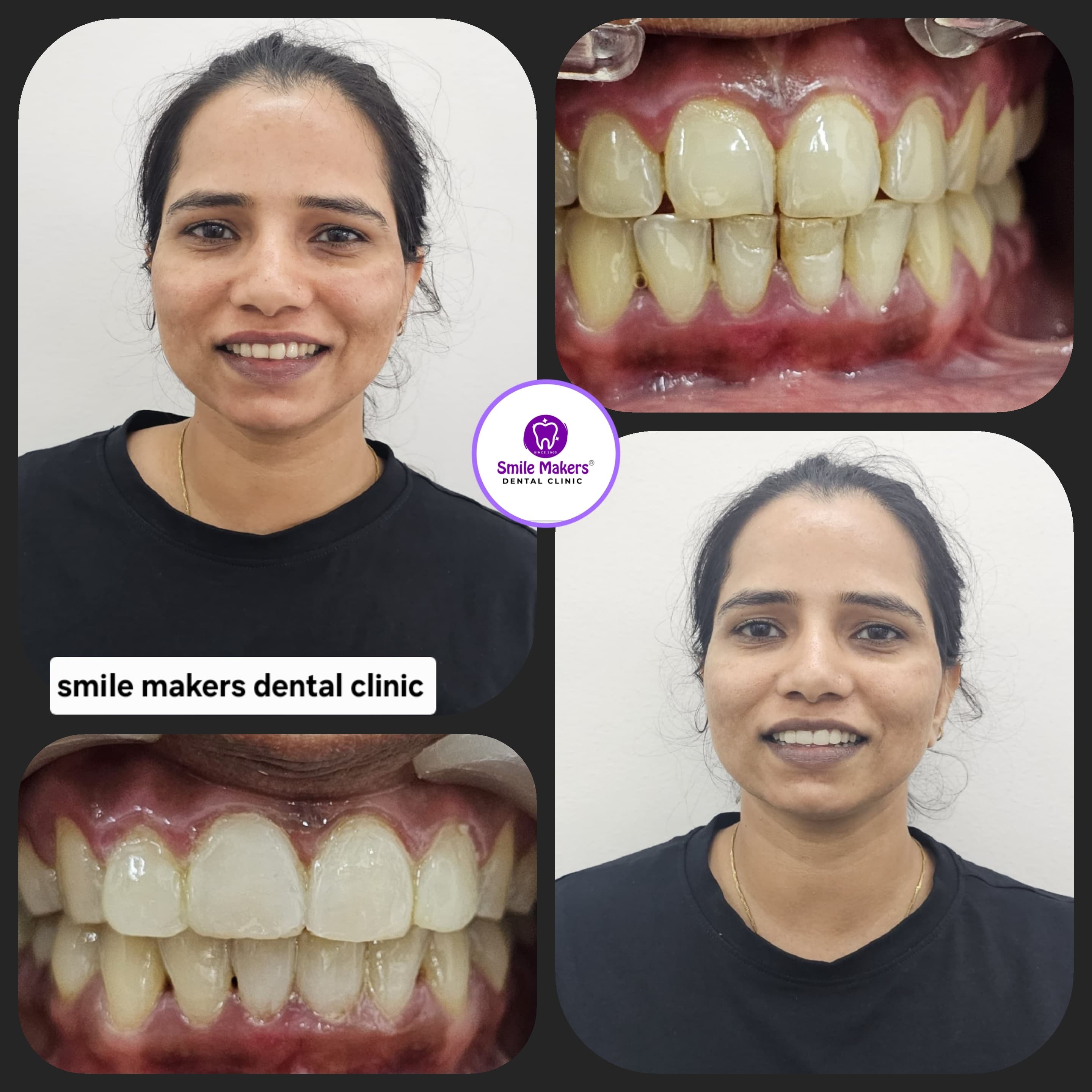 best smile transforming clinic in pimple saudagar! hesitant smiles to confident grins — every transf... main image