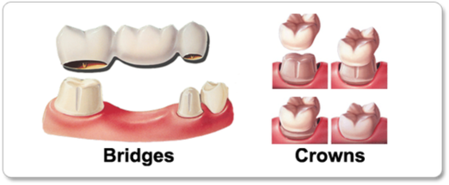 update image