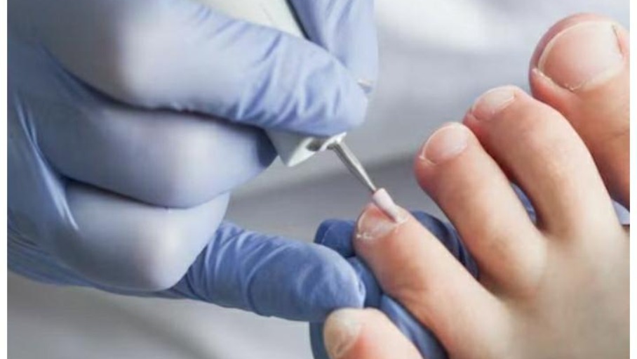 BEST NAIL SKIN CLINIC IN SALEM main image