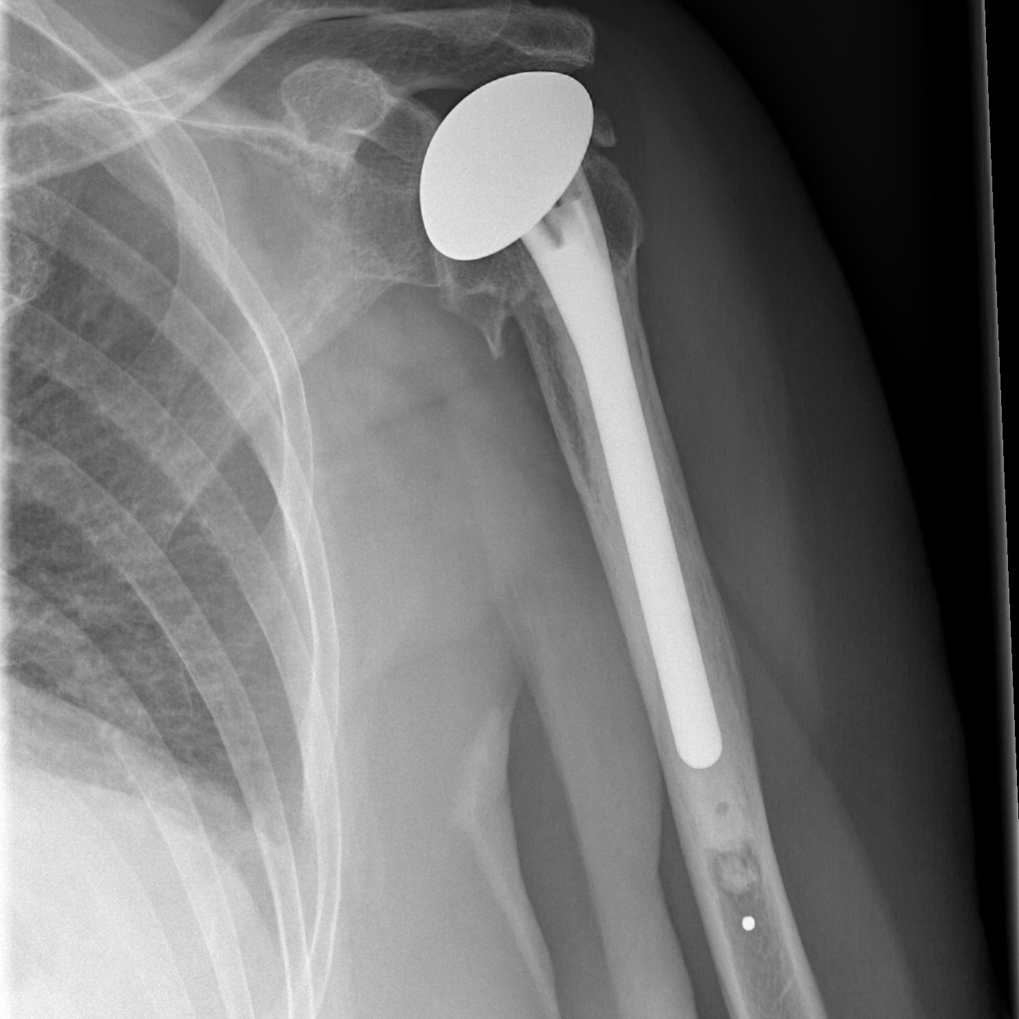Here’s a detailed description about Post-Operative Orthopaedic Physiotherapy Treatment tailored for main image
