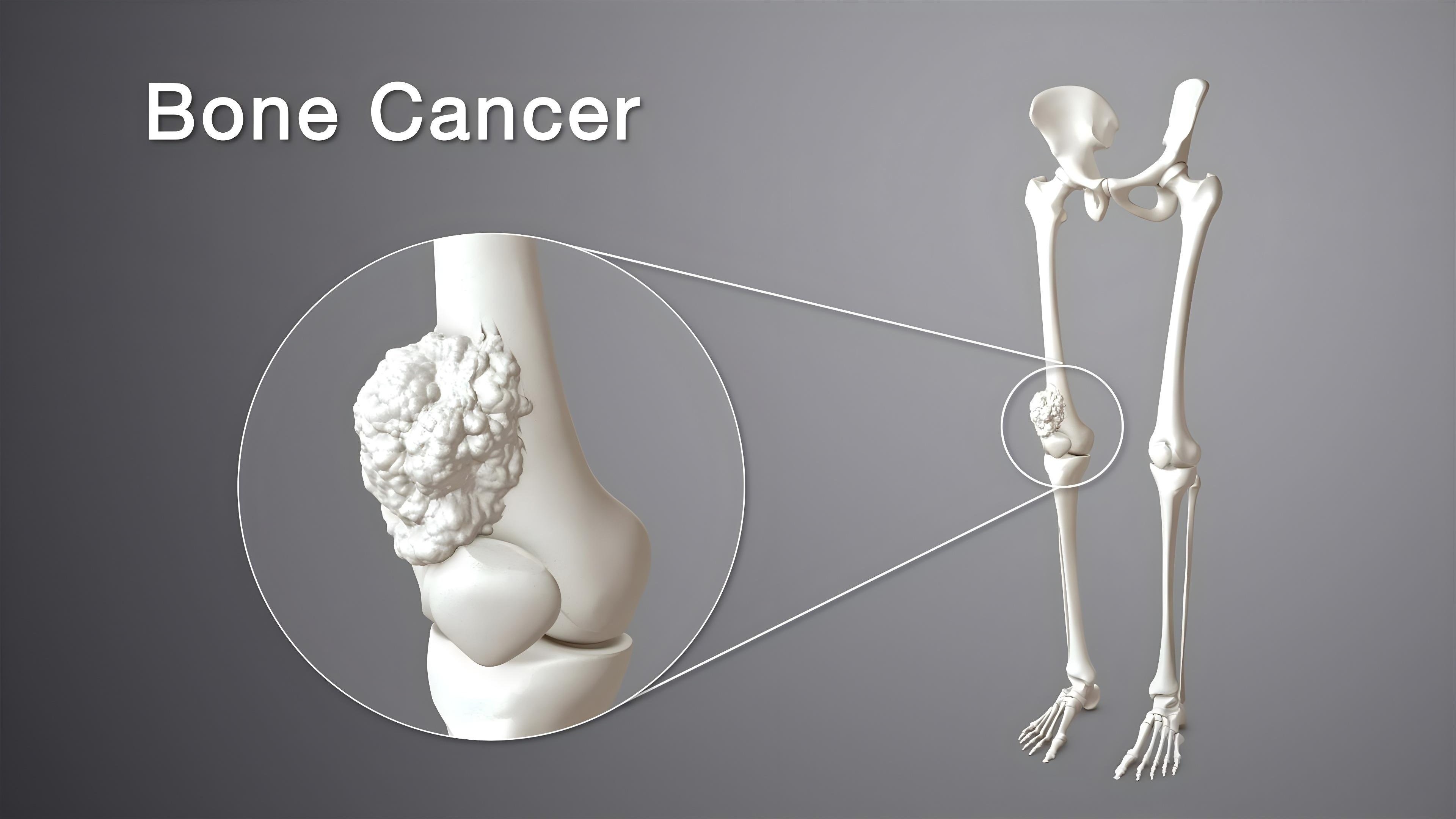 update image