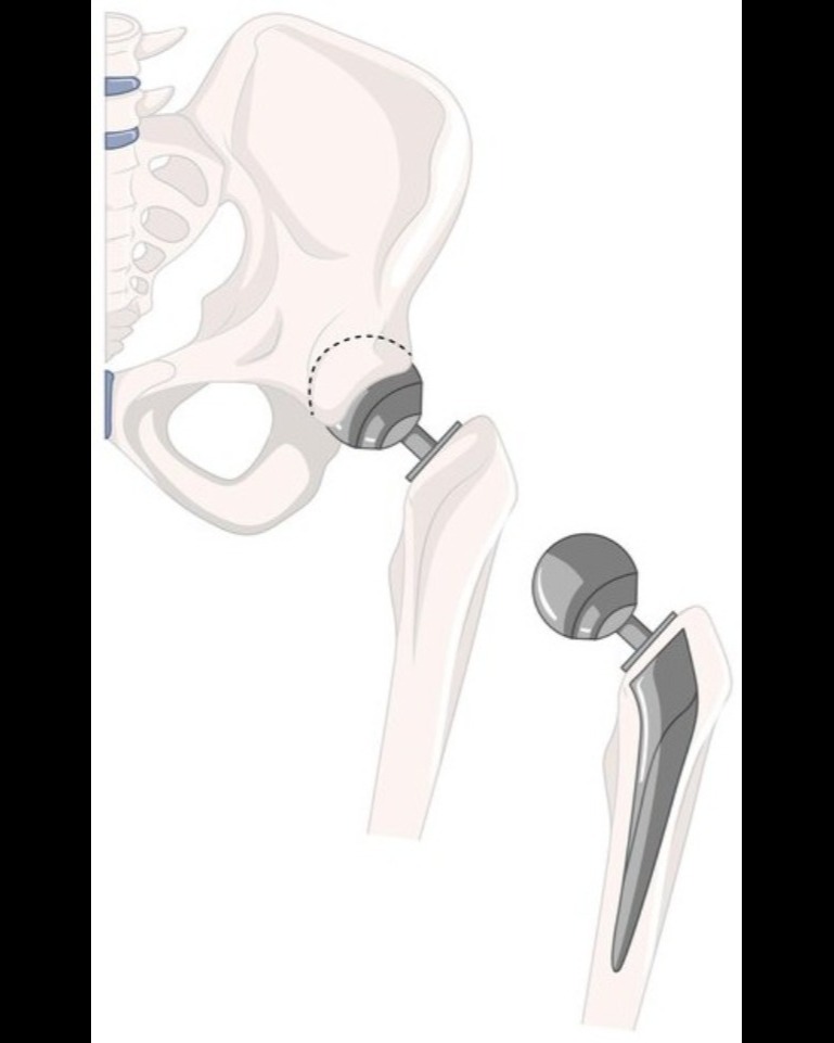update image