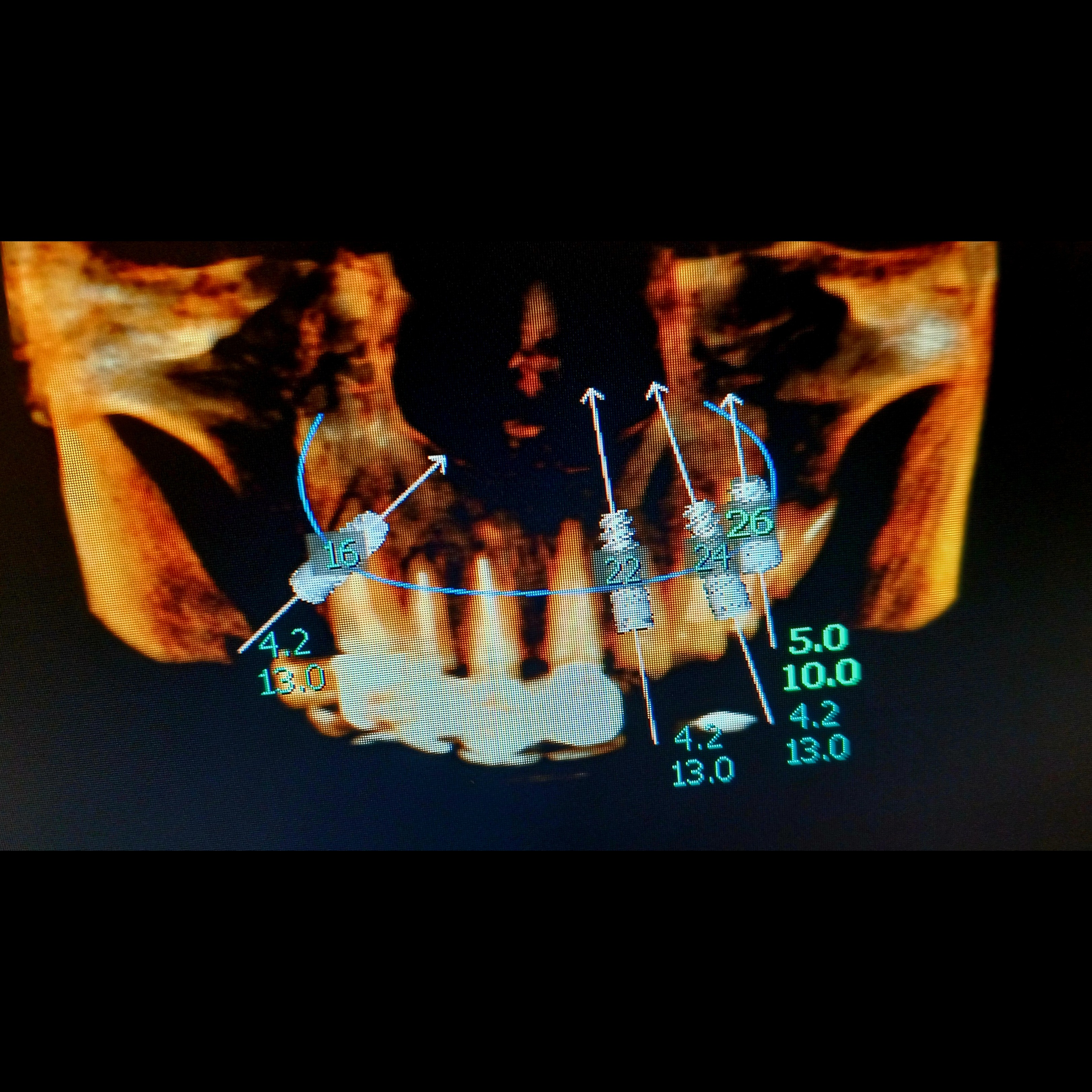 update image