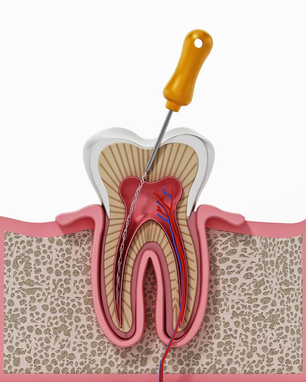 Root Canal in Rajouri Garden – Save Your Natural Tooth with Expert Care main image