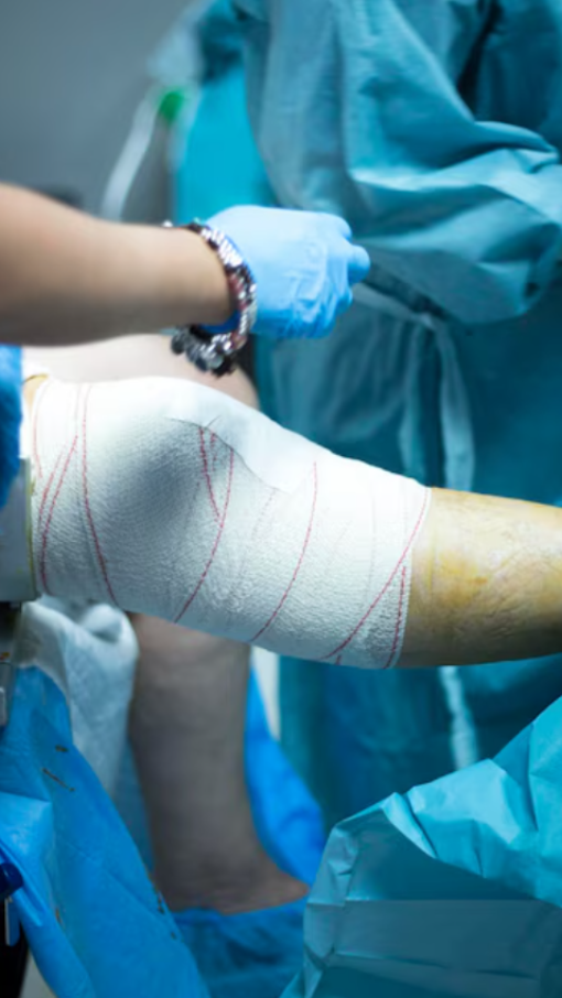 Orthopaedic Surgery in Chennai – Restore Mobility with Expert Care main image
