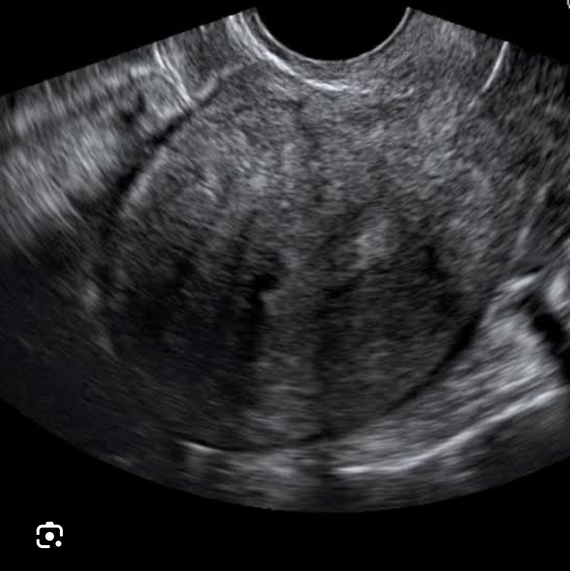 update image
