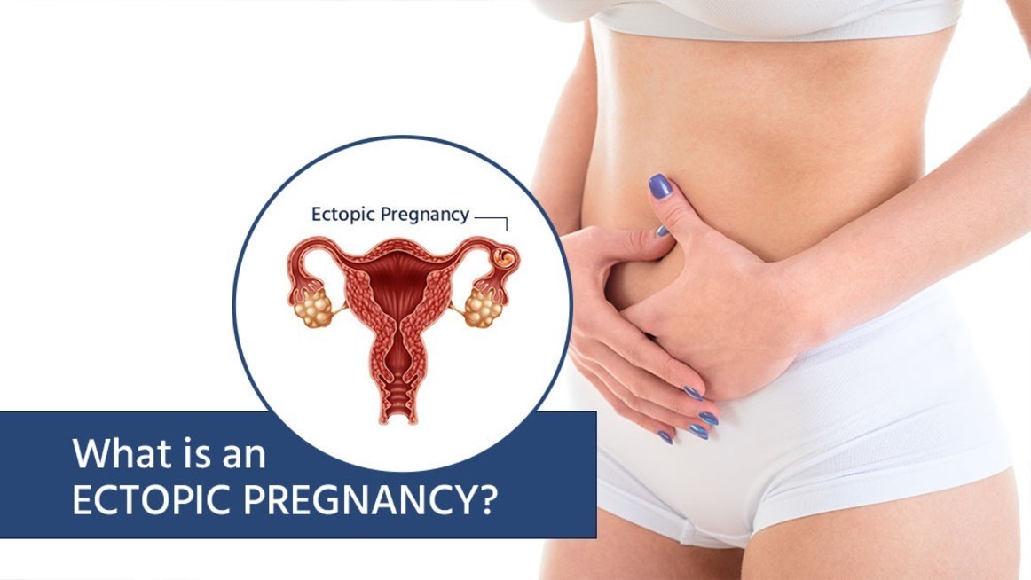 Ectopic Pregnancy Treatment in Nagpur – Quick Diagnosis, Safe Recovery main image