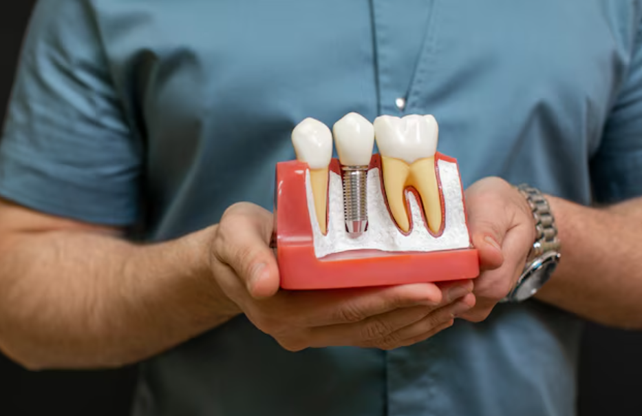 Immediate Loading Dental Implant in Delhi: Faster Smiles, Minimal Wait   main image