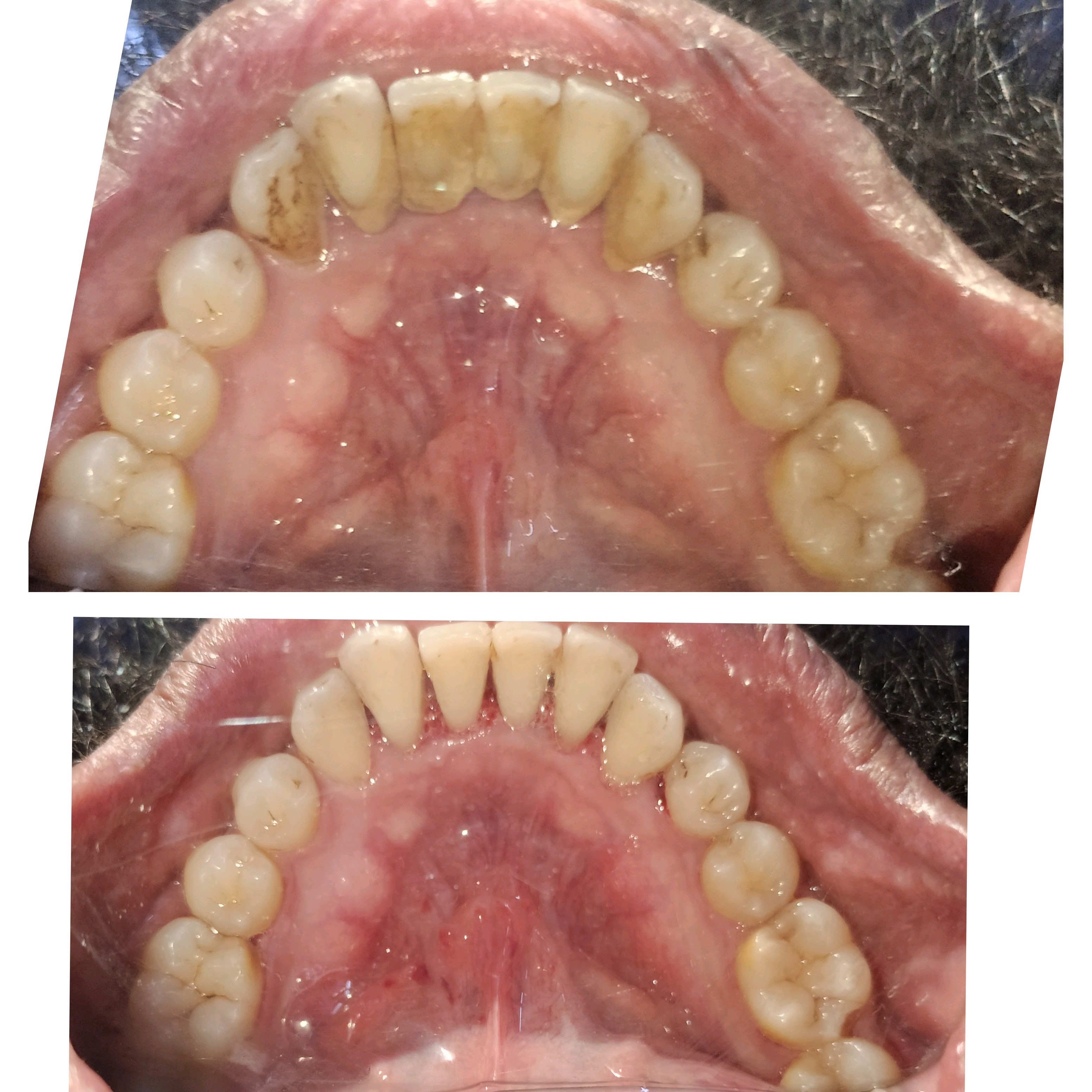 Teeth cleaning and polishing in Mira road East main image
