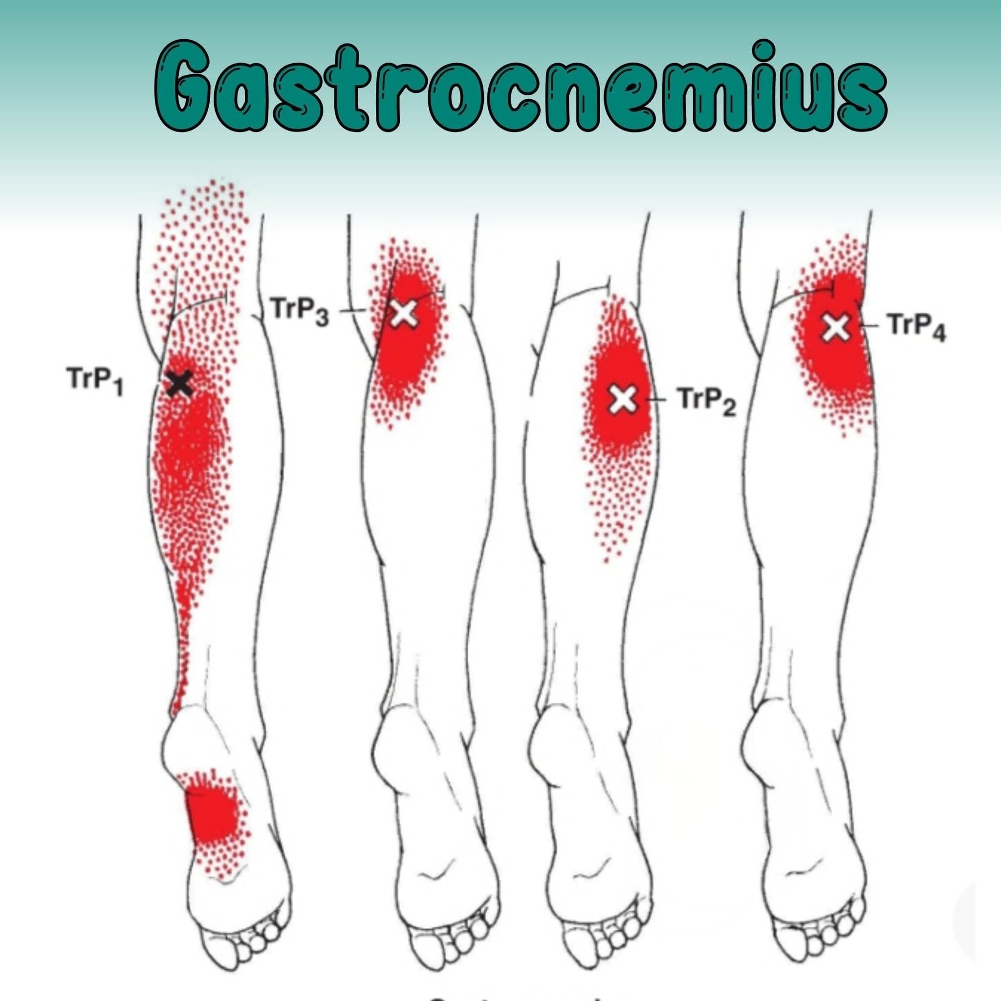 Gastrocnemius – “The Power Engine of Your Calf” main image