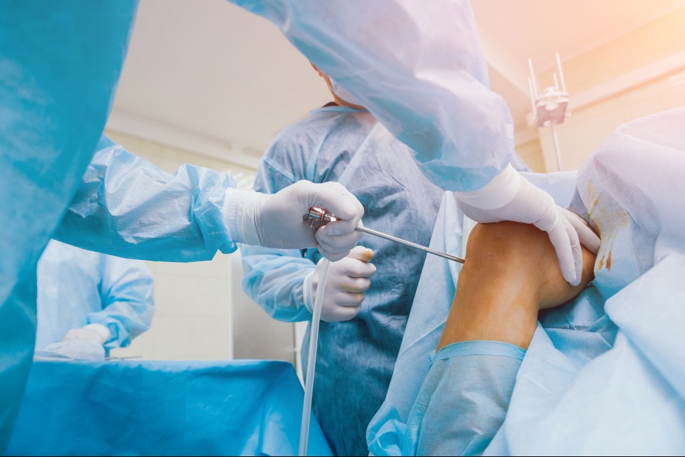 Arthroscopy in Chennai: Minimally Invasive Joint Solutions main image