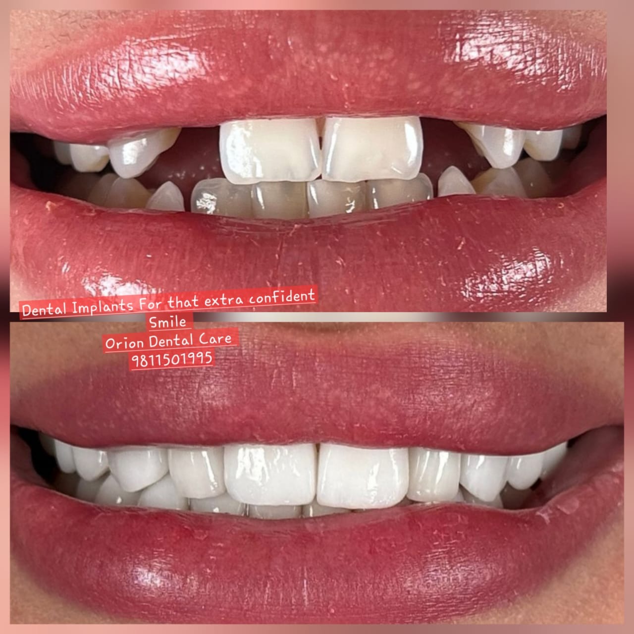 update image