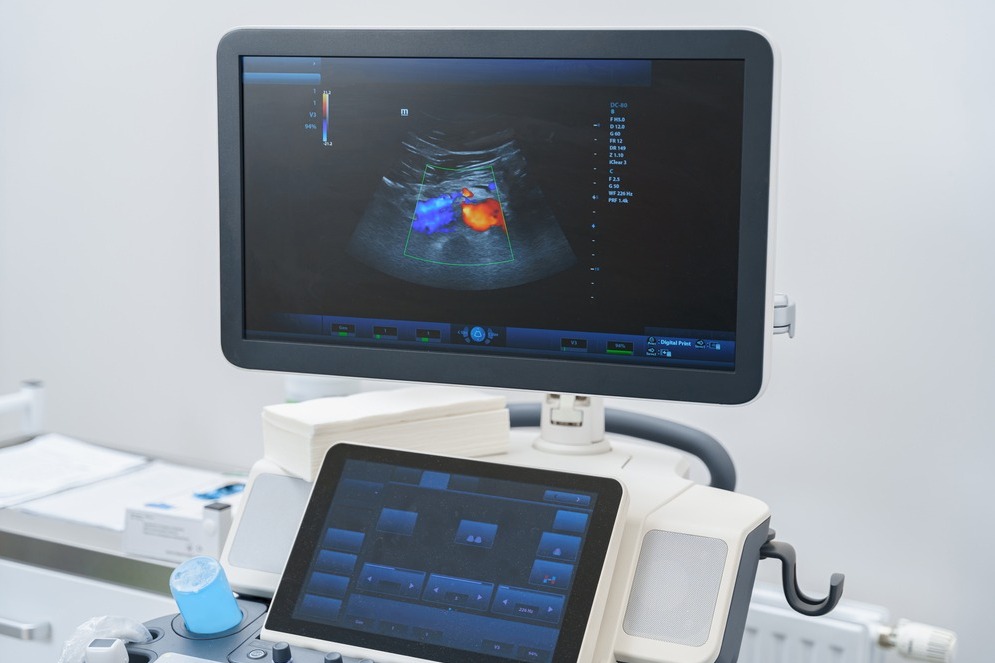 Colour Doppler Scan Services In Rasta Peth Pune main image