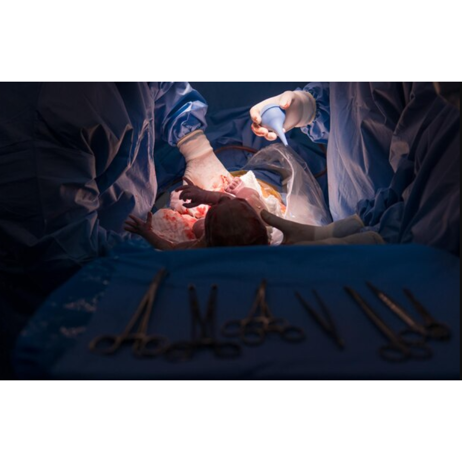 Cesarean Delivery in Nagpur main image