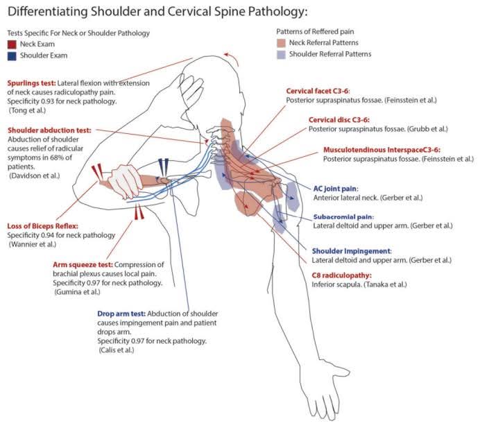 Differentiating Shoulder & Cervical Spine Pathology (Katsuura et al., 2020) main image