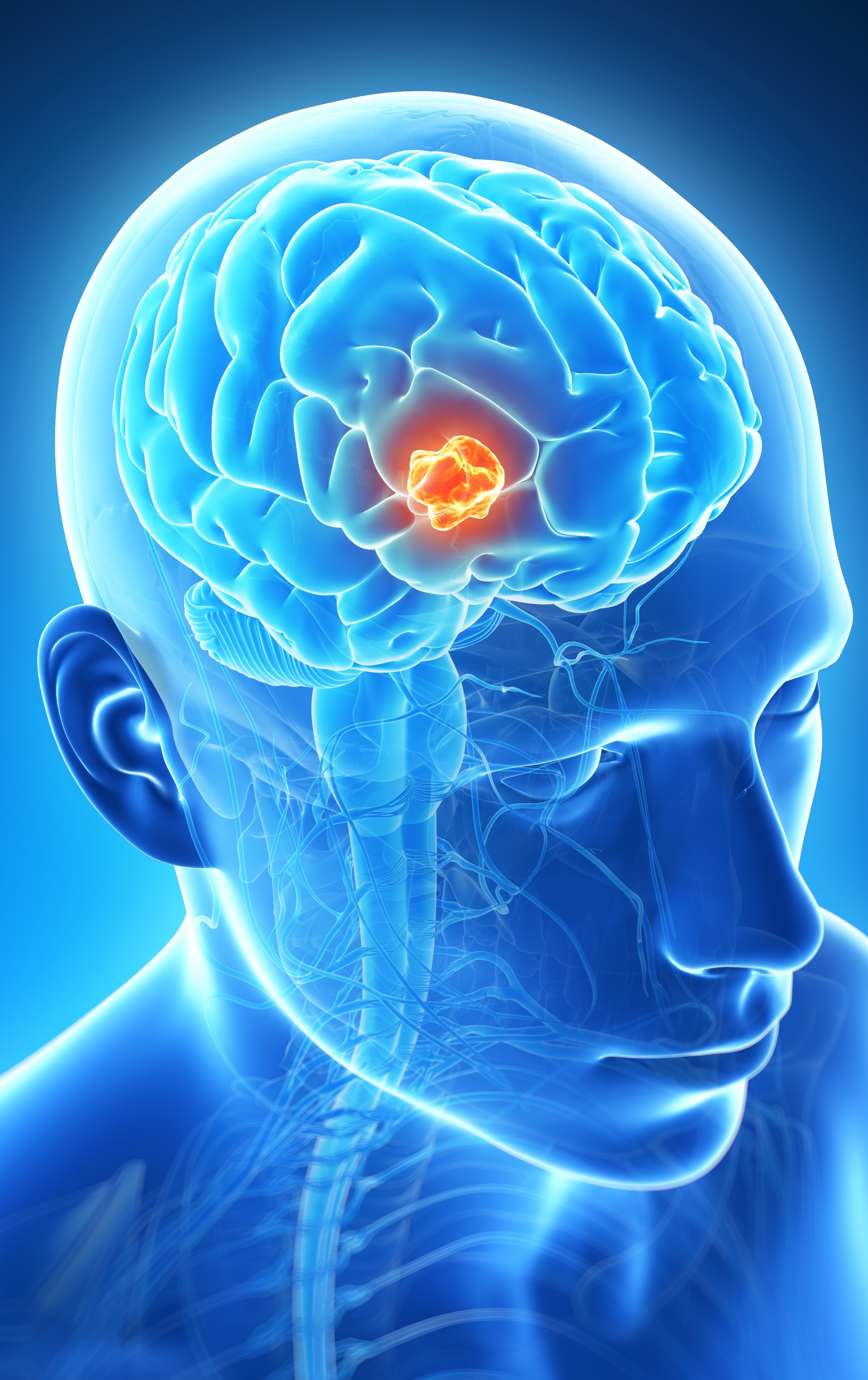 Best Surgeon for Brain Tumor in Jaipur with Trusted Expertise main image