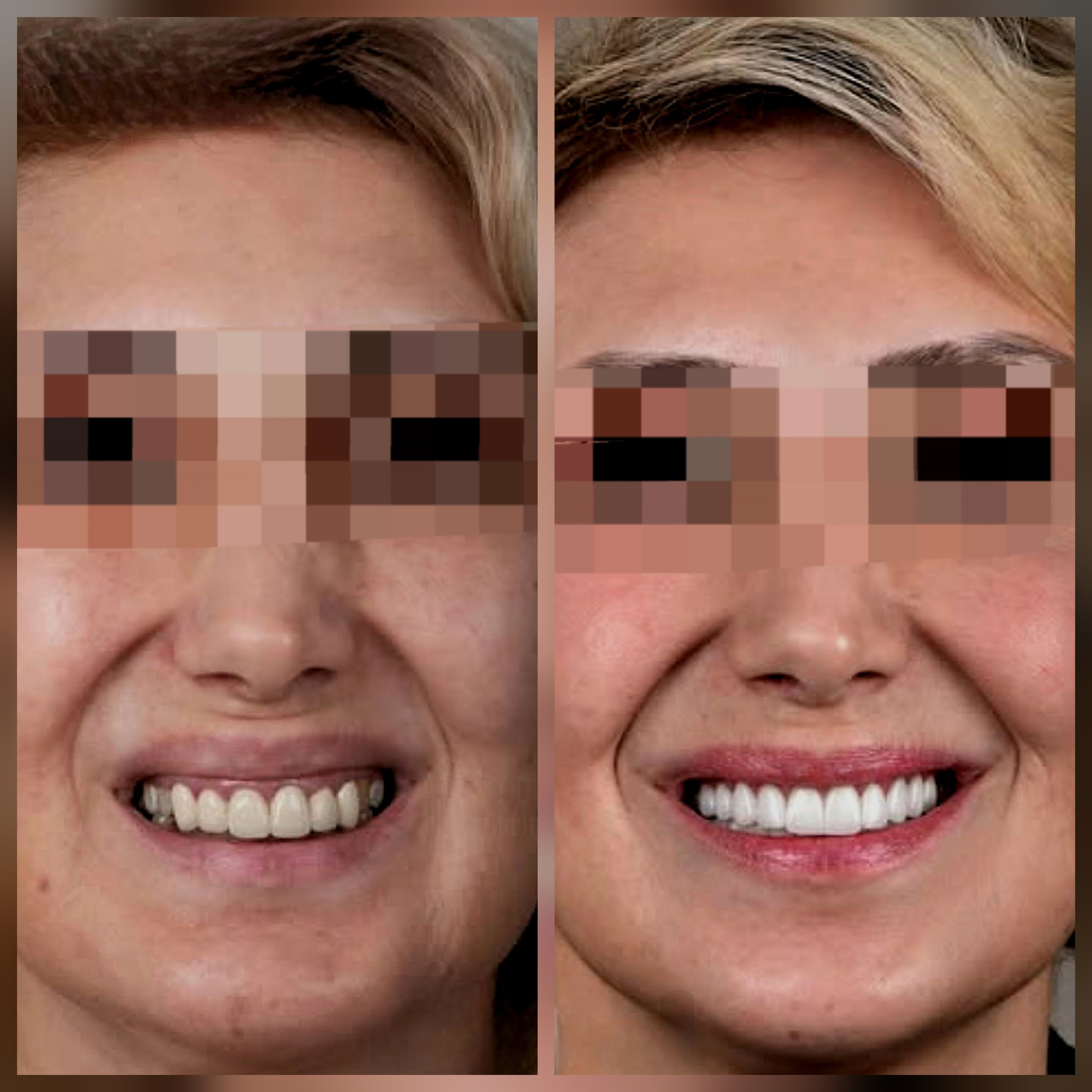 update image