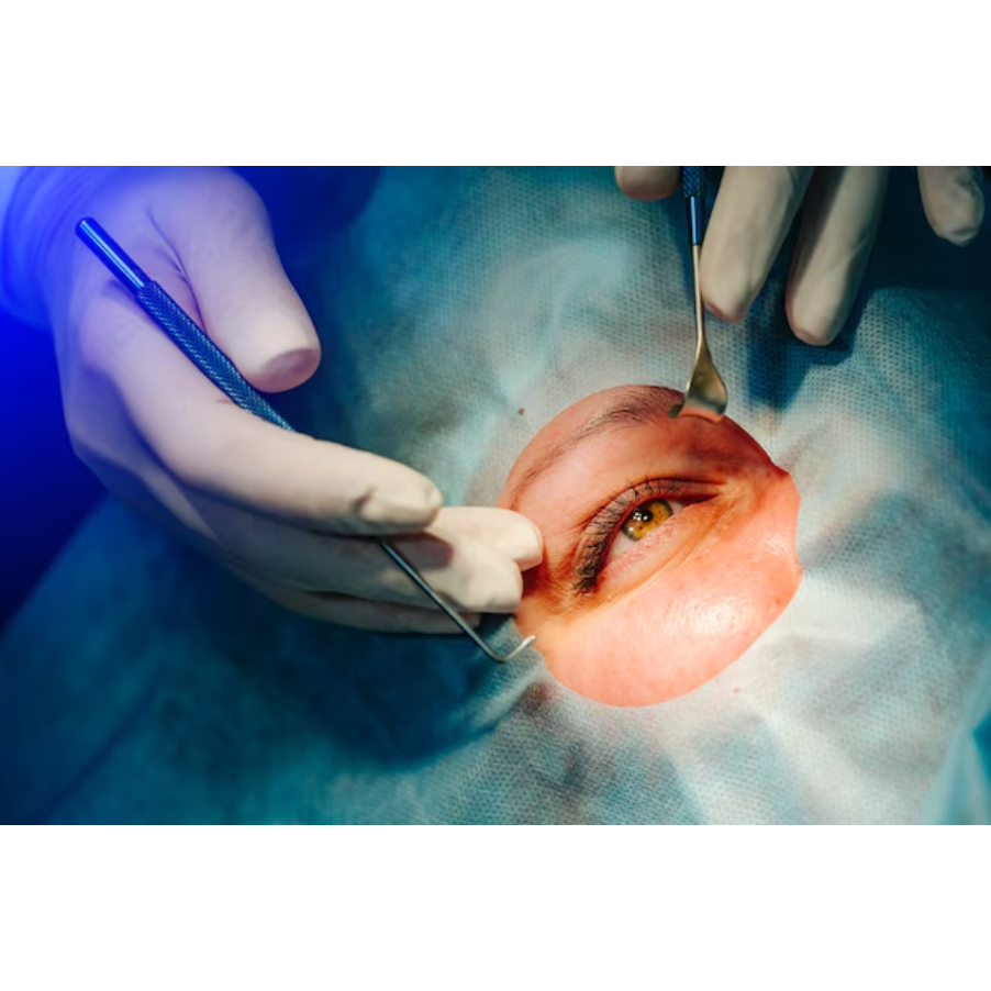 Micro-Incision Eye Surgery in Nagpur – Precision Procedures, Faster Healing main image