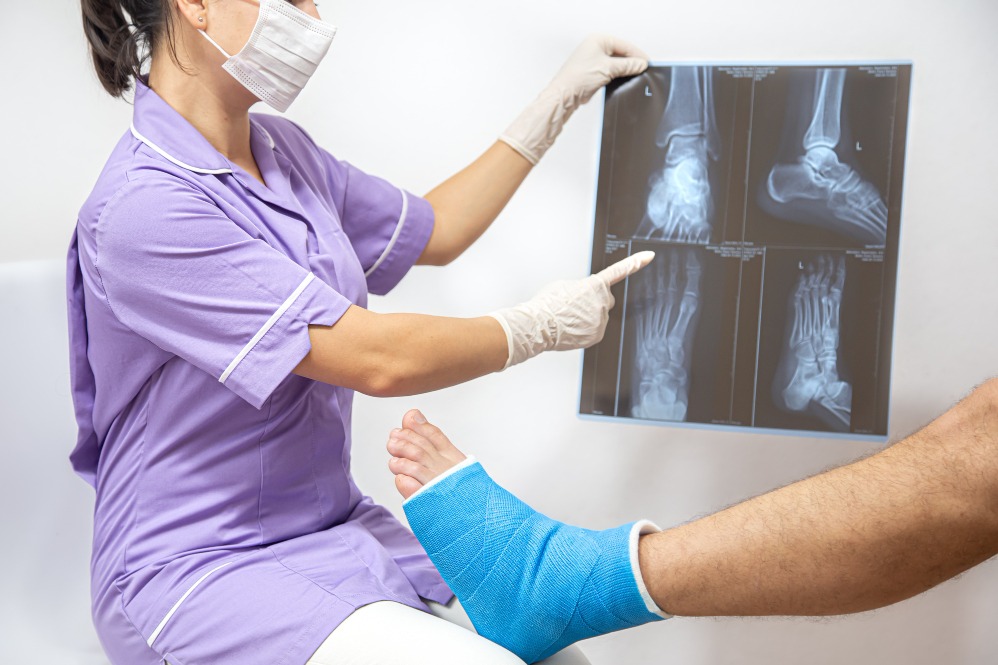 Fracture Treatment in Nagpur – Healing Bones with Expert Care main image