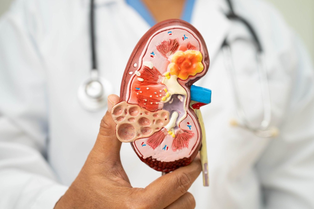 Best Kidney Transplant Doctor in Rajapark, Jaipur – Safe, Transparent Kidney Care main image