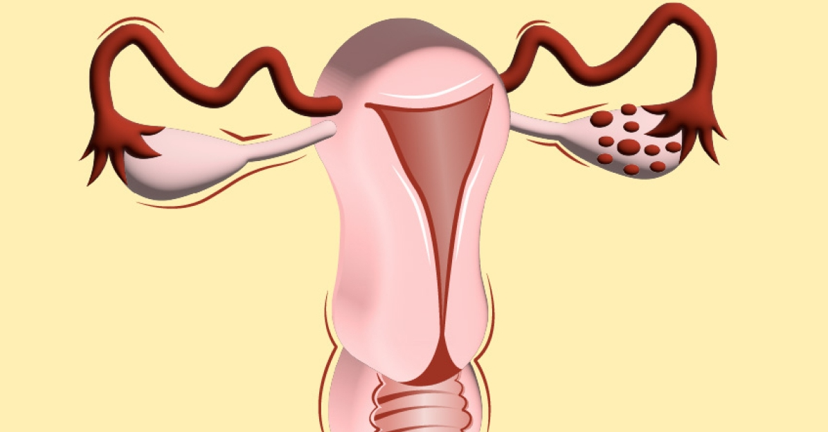 Breakdown of IVF treatment cost in Coimbatore main image
