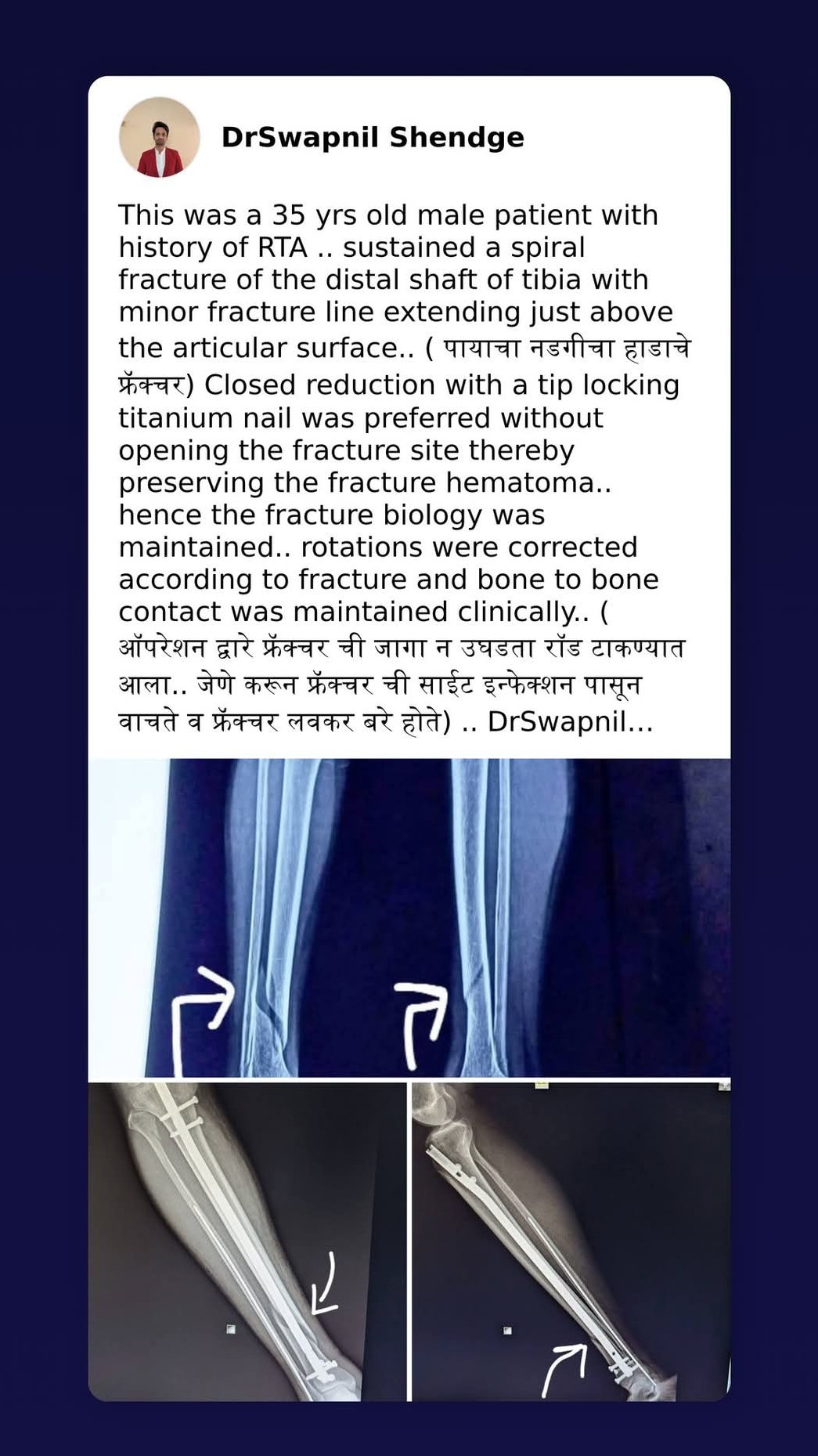 a recent operated case main image