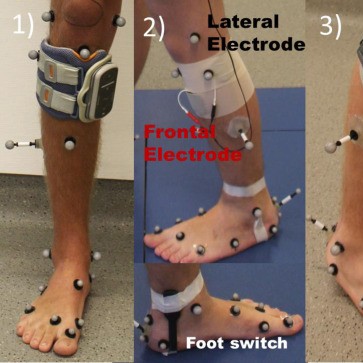 ELECTRICAL STIMULATION IN FOOT DROP Treatment at Sunshine clinic main image