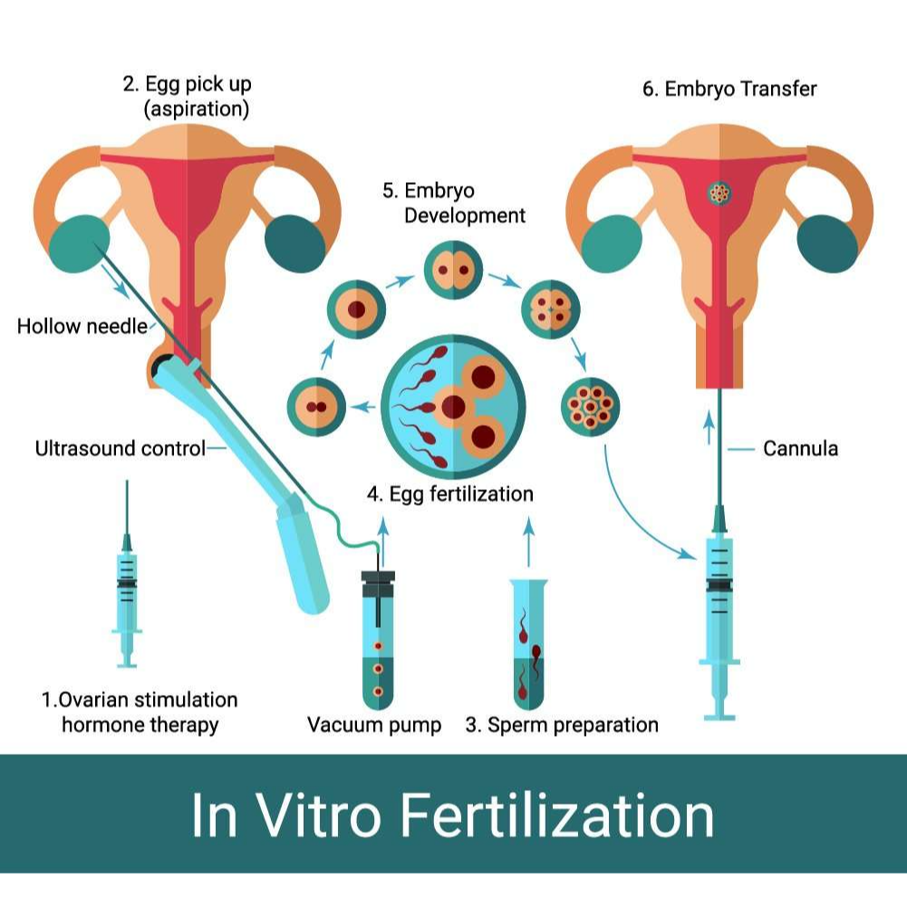 Best IVF Centre in Coimbatore with Fertility Experts main image