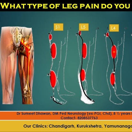 Leg pain and Physiotherapy Treatment at Sunshine clinic main image