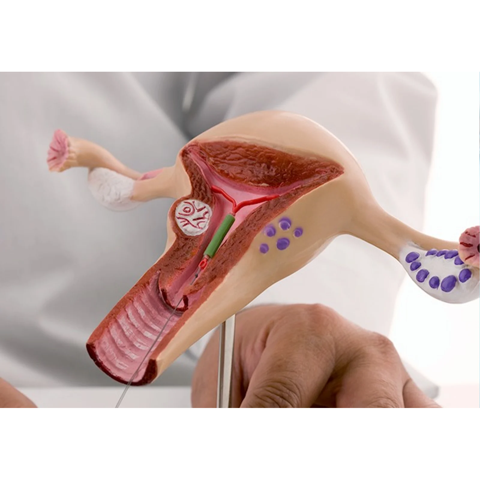 IVF Fertility Care Near Me in Coimbatore | Best Hospital main image