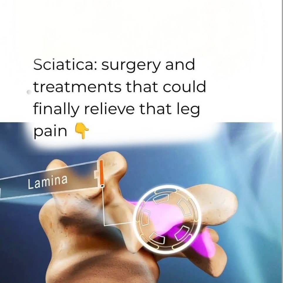 Not every low back pain need surgery main image
