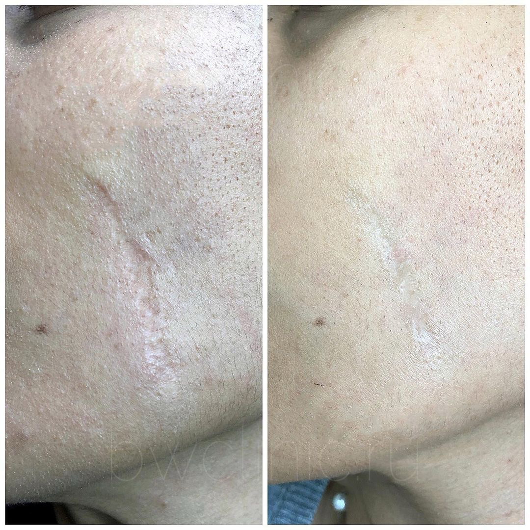 update image