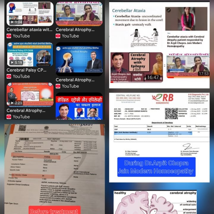 update image