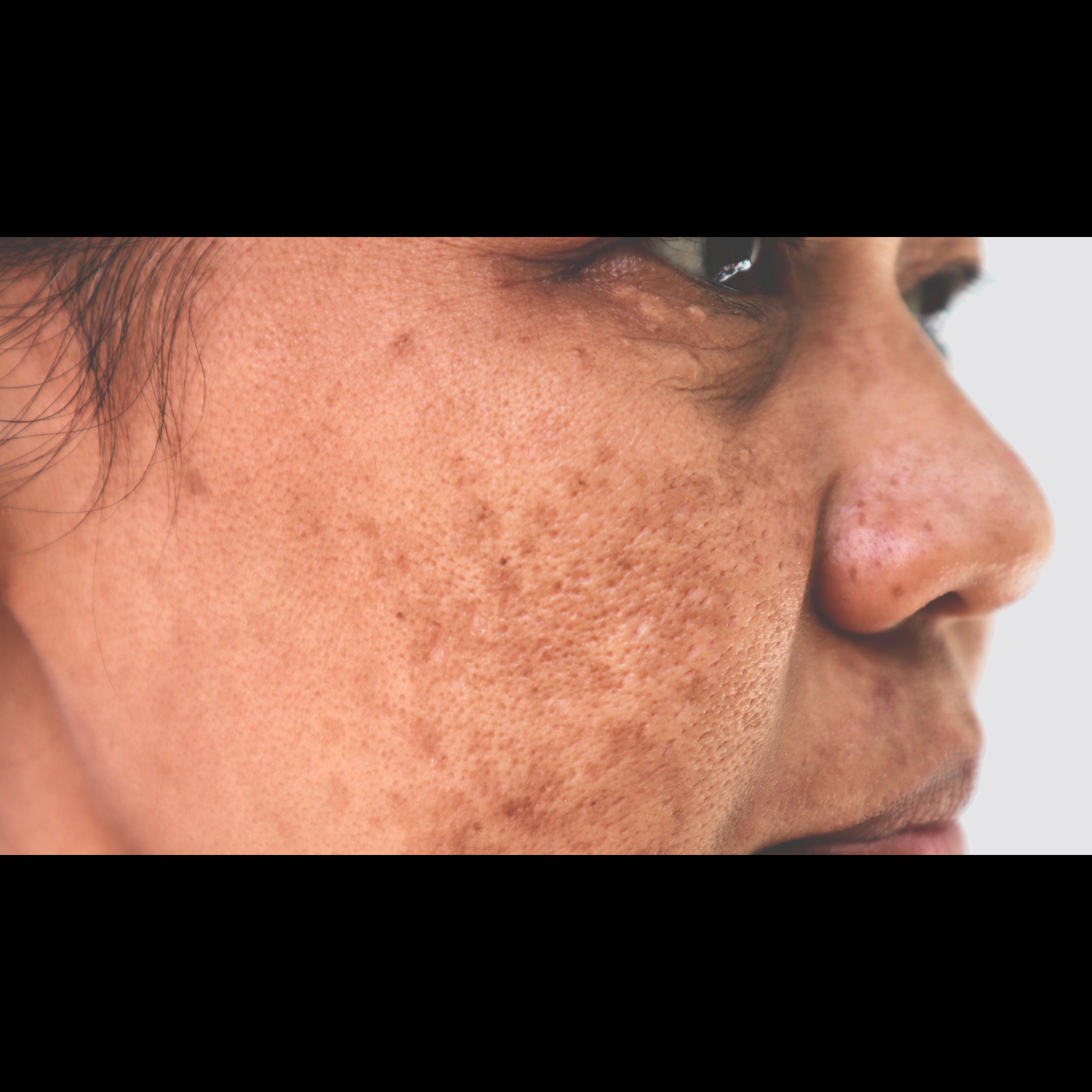 Skin Care Doctor Salem main image