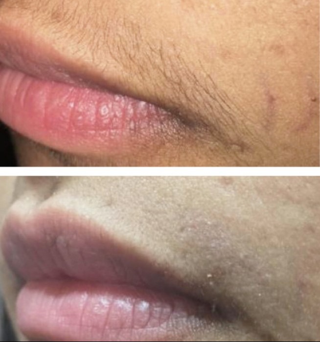 laser skin clinic In salem main image