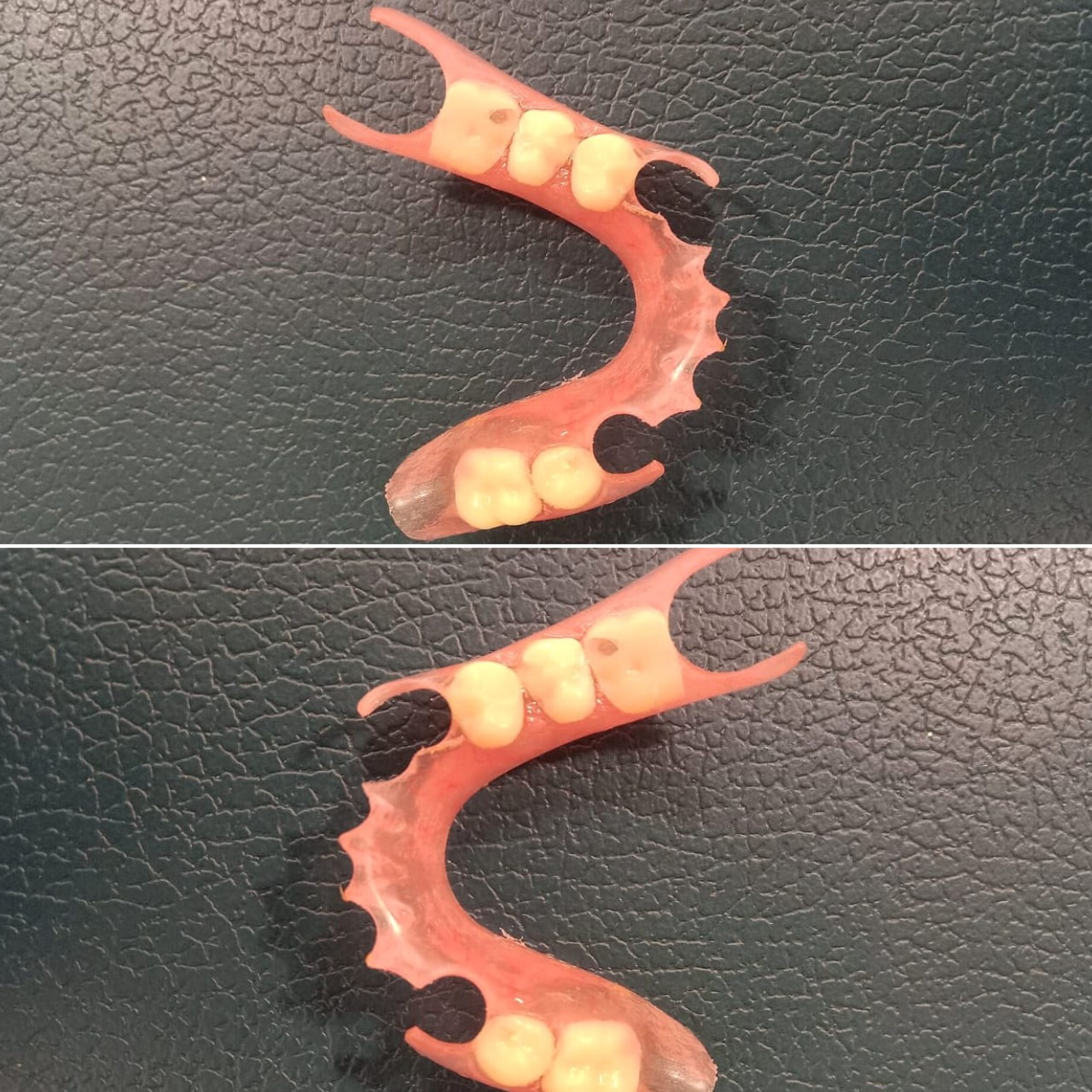 update image