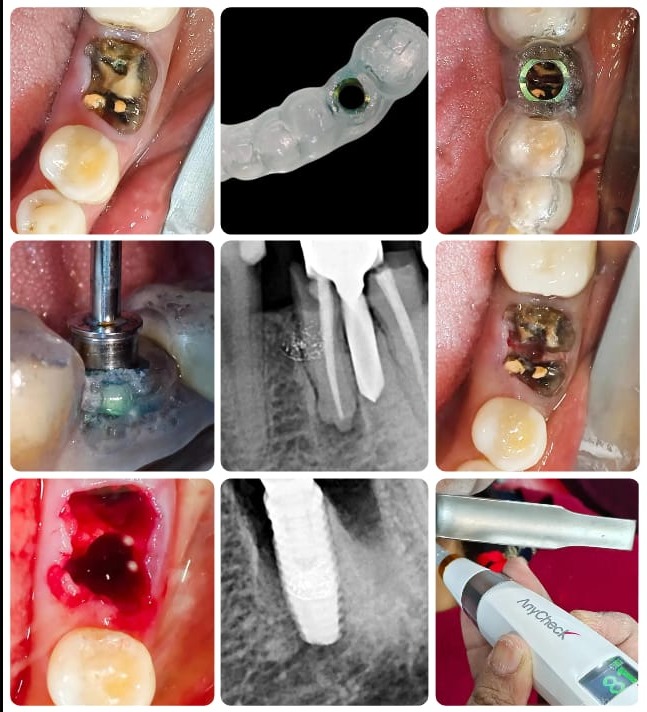 update image