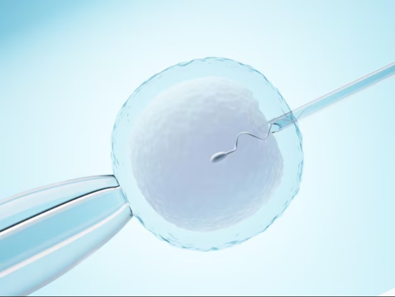 Best IVF Hospital in Chennai – Where Expertise Meets Advanced Technology main image