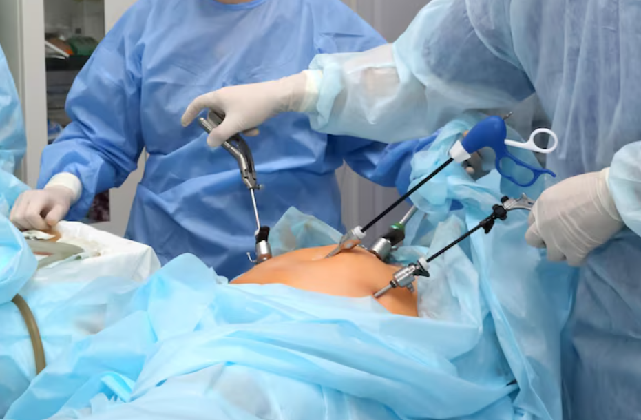 Laparoscopic Hysterectomy in Chennai main image