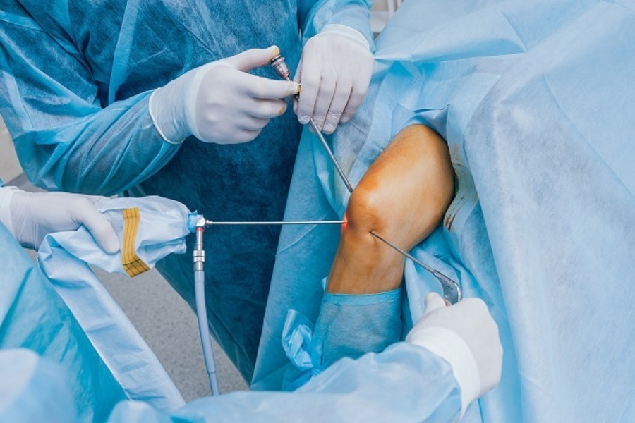 Knee Arthroscopy in Nagpur – A Minimally Invasive Approach to Joint Care main image