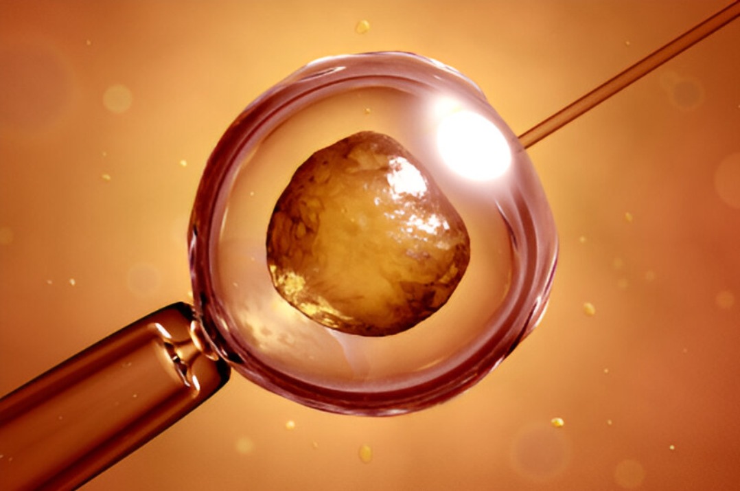 Top IVF Centre in Coimbatore | Leading Fertility Treatments main image