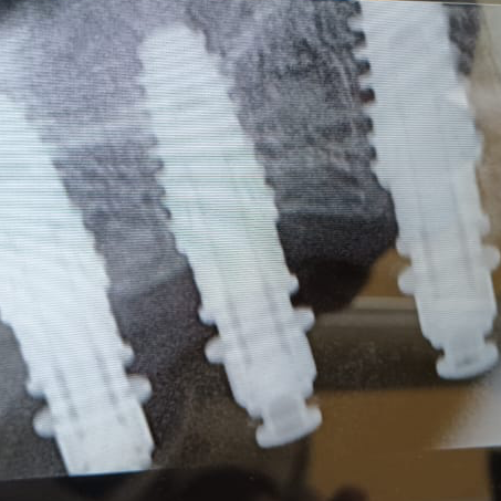 update image
