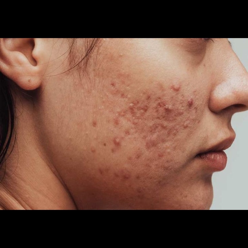 Skin Care Clinic In Salem main image