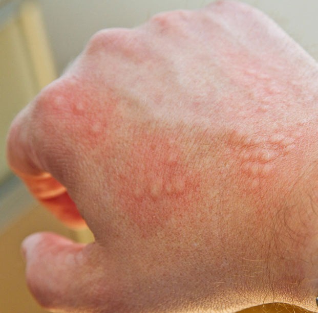 Skin Specialist Doctor Near Me IN Salem  main image