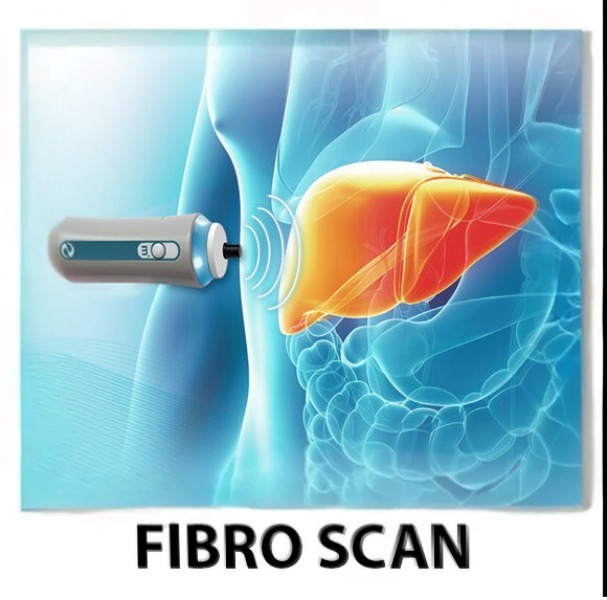 Accurate Fibroscan in Rasta Peth – Early Detection for Liver Health main image