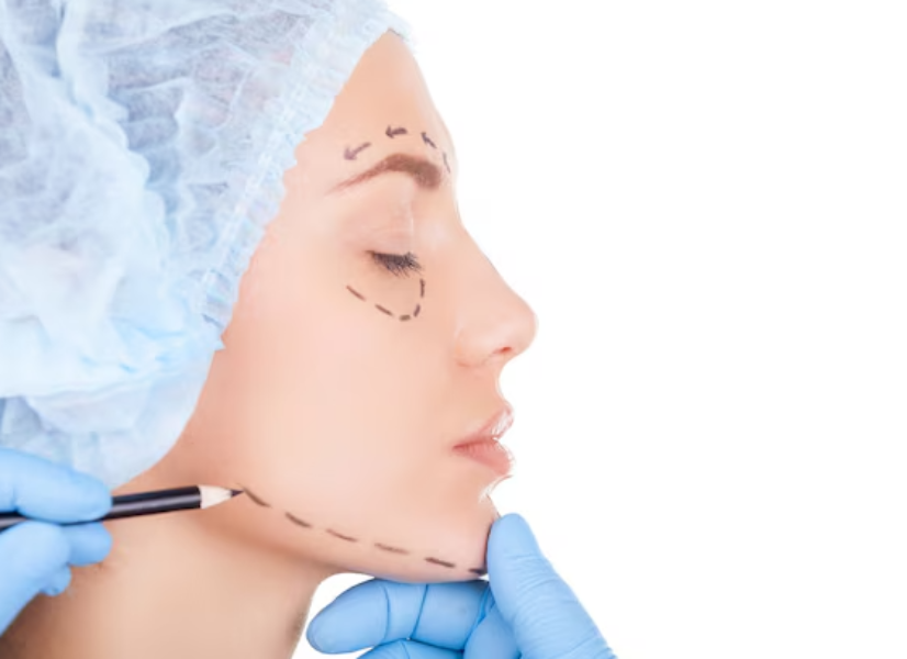Plastic Surgery in Chennai – Enhancing Confidence with Expert Care main image