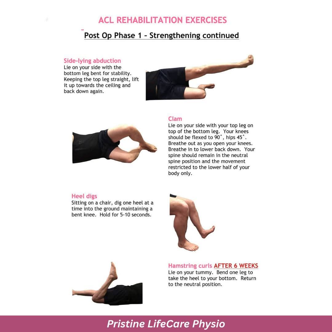 ACL (Anterior Cruciate Ligament) rehab at Sunshine clinic main image
